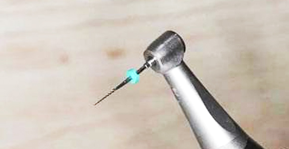 精細(xì)切割，極大程度保留牙神經(jīng)，根管治療成功率極高