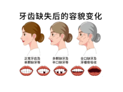 【科學(xué)科普】十個(gè)常用的口腔小知識(shí)！