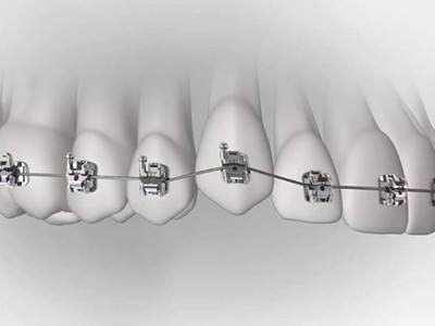 承德市哪家口腔醫(yī)院口腔正畸做得好？惟德口腔醫(yī)院來告訴您