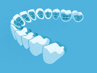 惟德口腔醫(yī)院口腔正畸好不好？