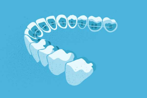 惟德口腔醫(yī)院口腔正畸好不好？